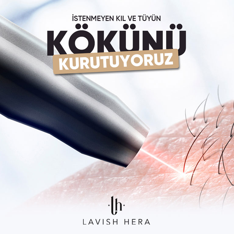 Sosyal Medya Çalışması 21